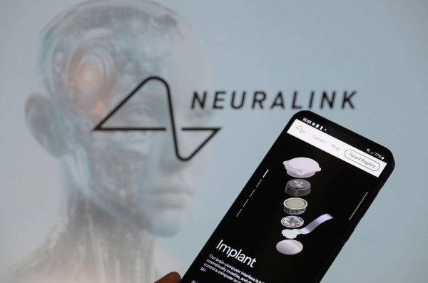 浙商证券证交所 马斯克脑机公司Neuralink申请“心灵感应”商标，暂时被驳回